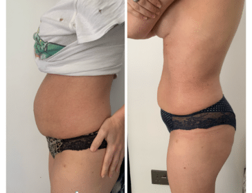 GIVEAWAY: WIN A 5-Day Jamu Postnatal Treatment From Mummies & Bellies