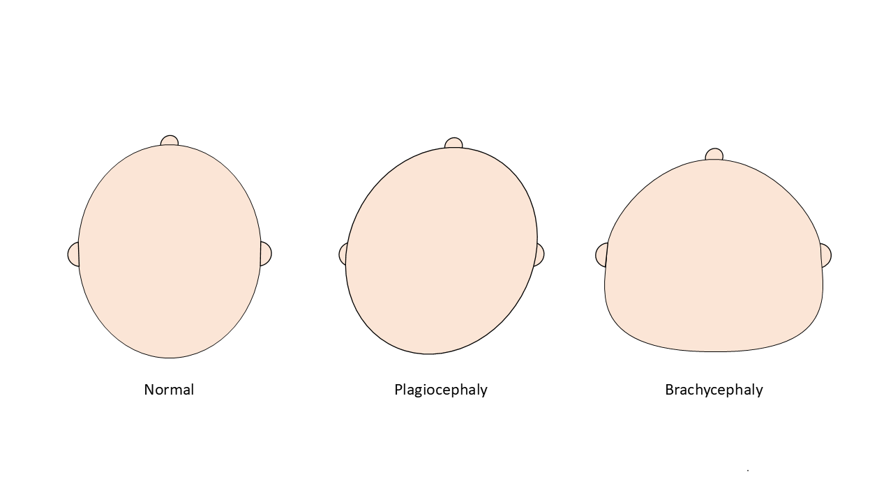 KKH PlagioCentre Singapore